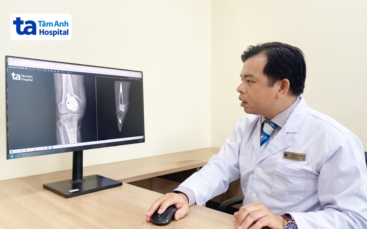 Bác sĩ Lý đánh giá vị trí khối u phá hủy phần lớn cấu trúc khớp gối của anh Thái.