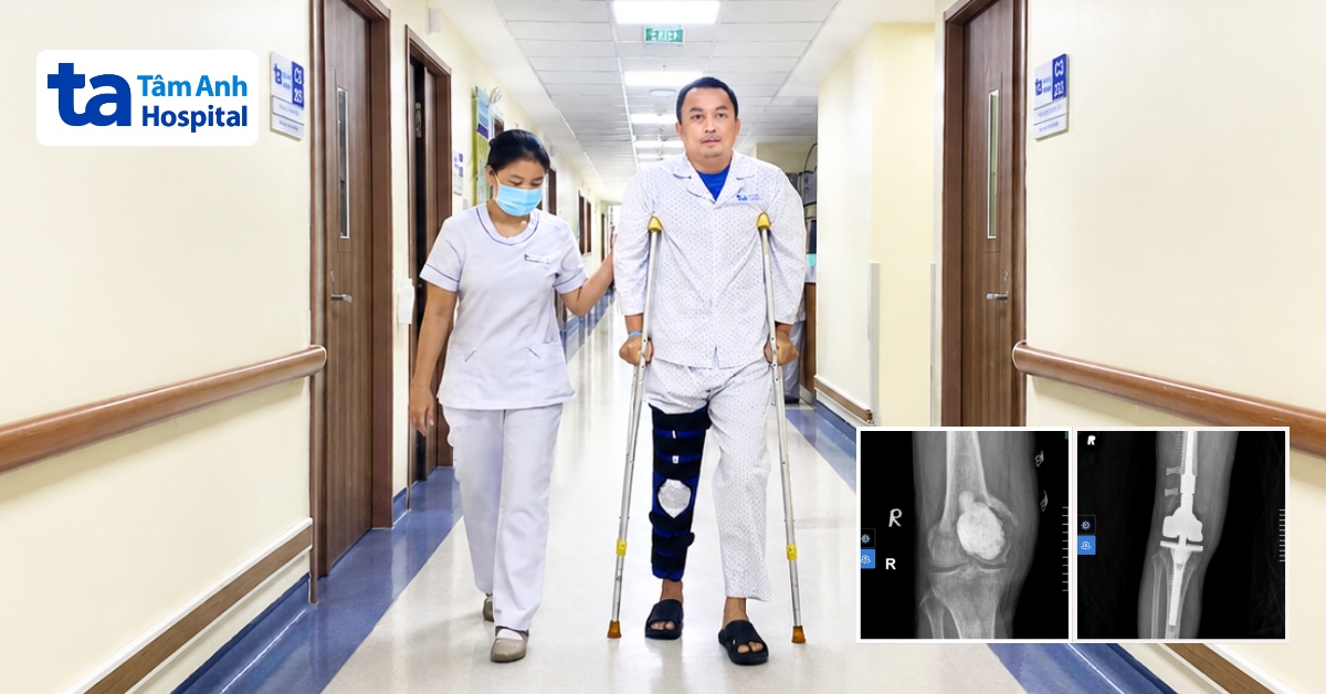 Cắt khối u hủy xương và thay khớp gối cho người đàn ông