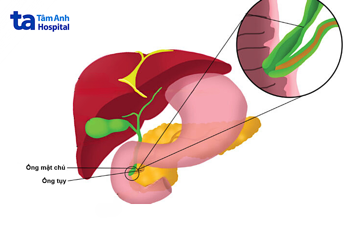 Minh họa vị trí ống mật chủ và ống tụy trong hệ tiêu hóa.