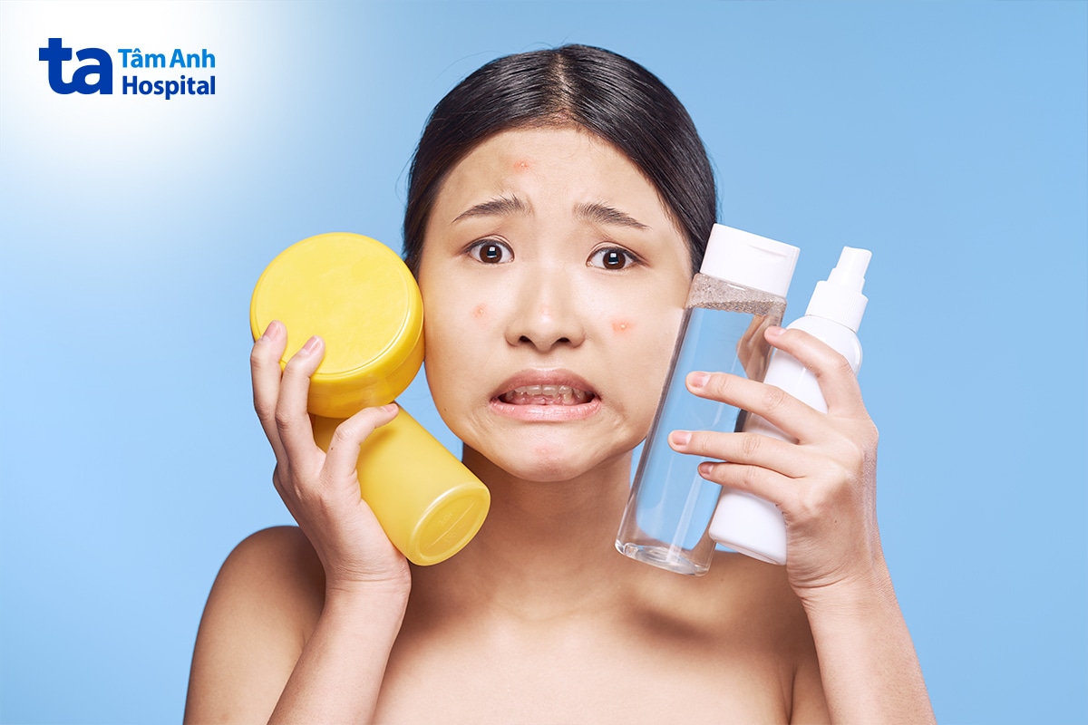 Chăm sóc da phù hợp giúp kiểm soát mụn ở tuổi dậy thì.