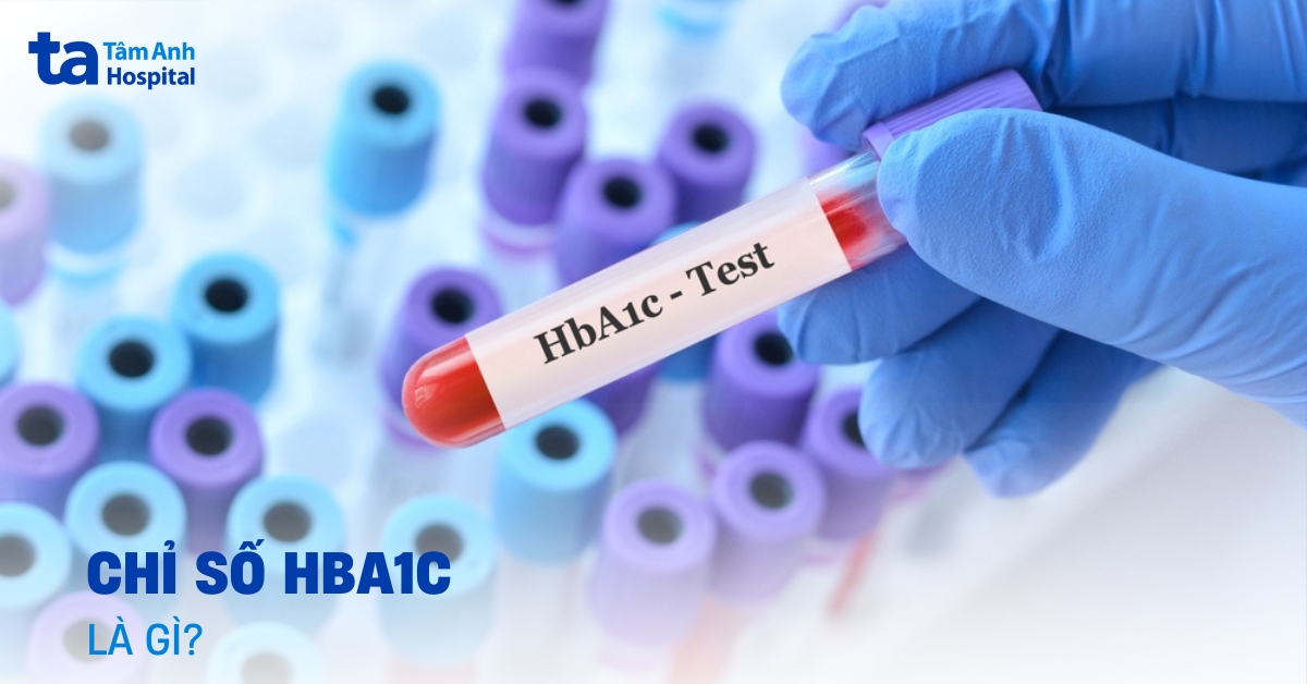 Chỉ số HbA1c là gì? Ý nghĩa trong chẩn đoán, điều trị tiểu đường