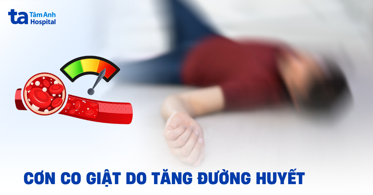 Cơn co giật do tăng đường huyết cần xử trí ra sao?