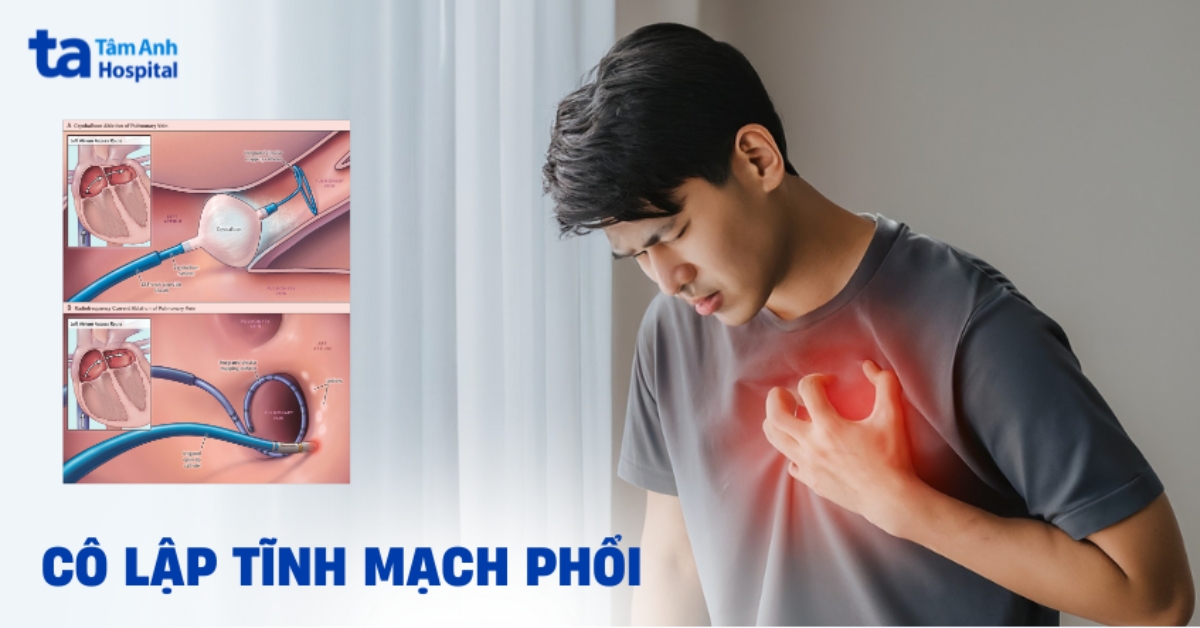 Cô lập tĩnh mạch phổi: Đối tượng nào cần thực hiện?