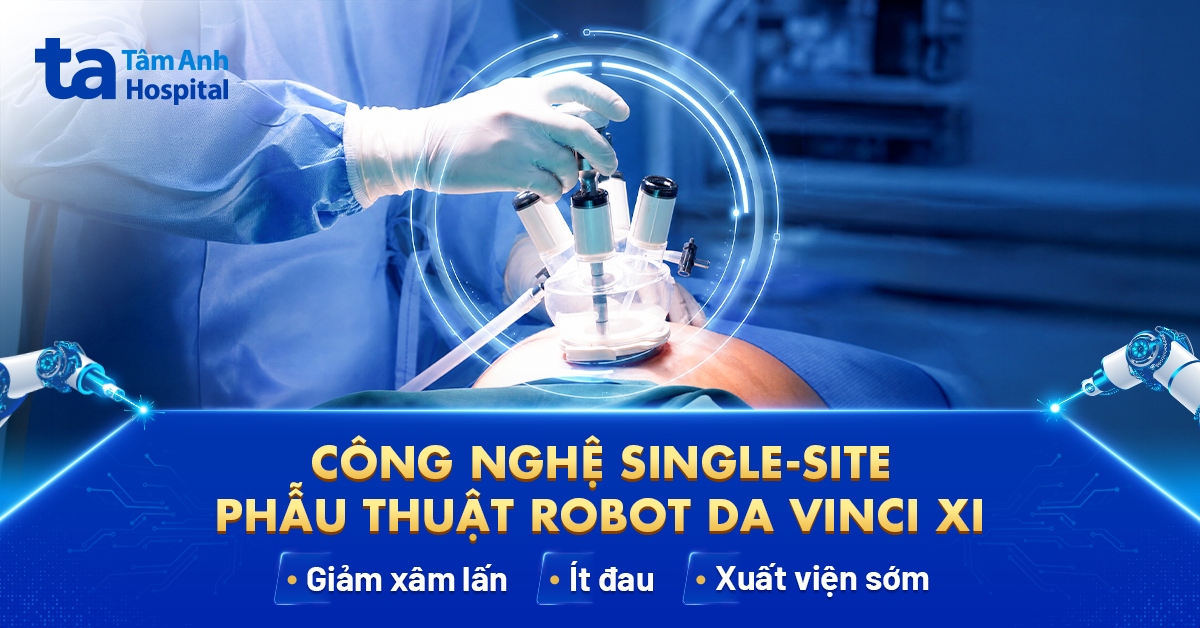 Phẫu thuật nội soi 1 vết mổ bằng Robot: Chỉ định và quy trình
