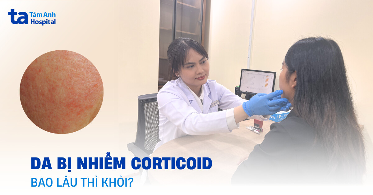 Da bị nhiễm corticoid bao lâu thì khỏi?