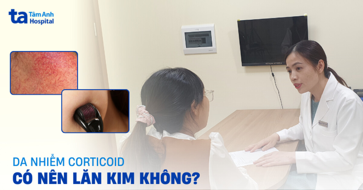Bác sĩ giải đáp: Da nhiễm corticoid có nên lăn kim?