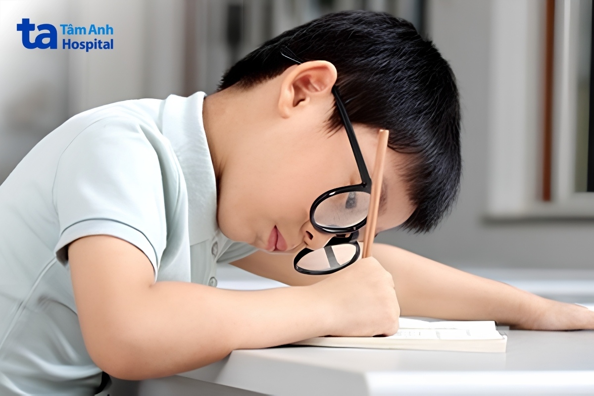 dấu hiệu cận thị bẩm sinh