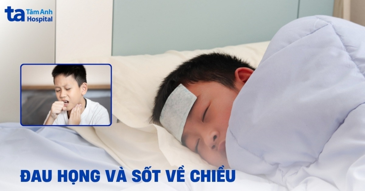 Đau họng và sốt về chiều: Các bước để cải thiện dần