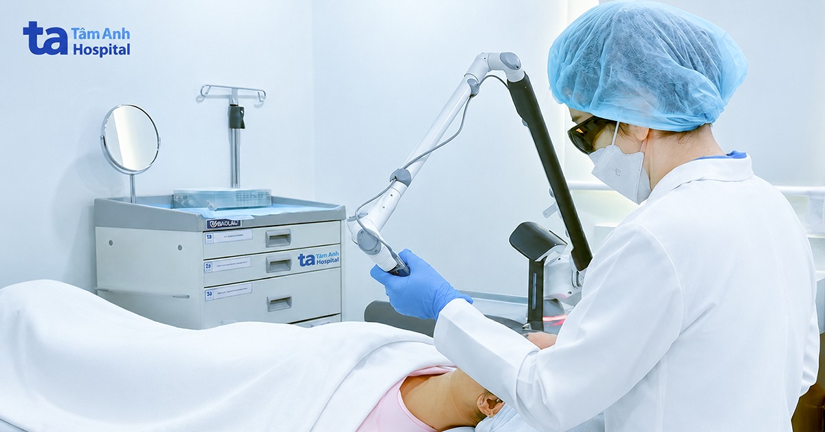 Điều trị nám kéo dài sau thai kỳ bằng laser