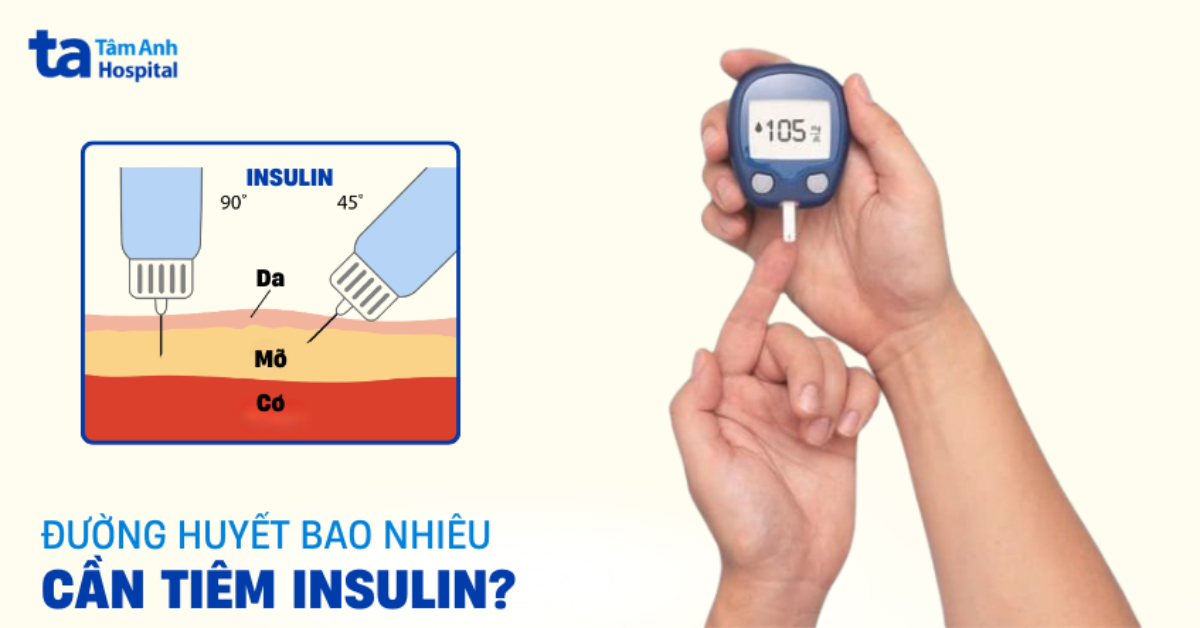 Đường huyết bao nhiêu thì tiêm insulin? Tính liều tiêm thế nào?