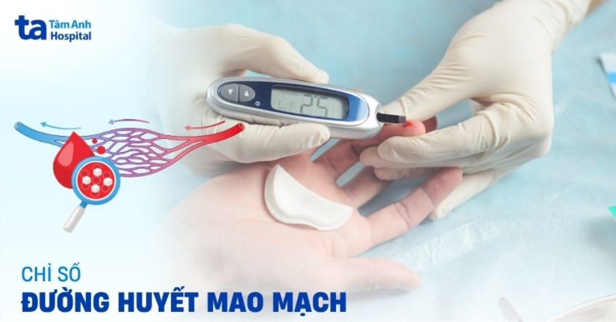 Đường huyết mao mạch bình thường là mức nào?