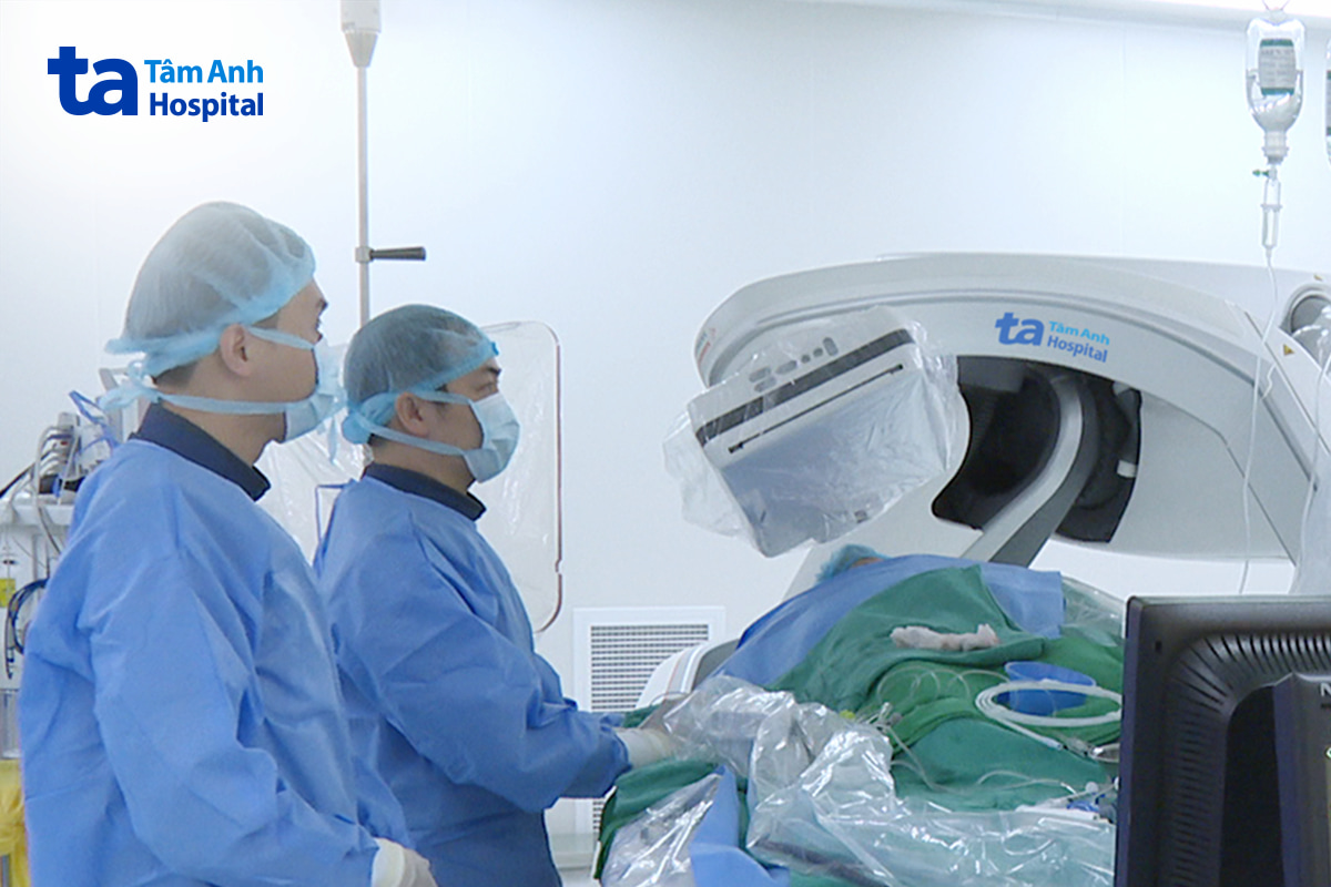 Êkíp sử dụng kỹ thuật tán vôi nội mạch bằng bóng phát sóng xung kích (IVL), sau đó đặt stent để khôi phục dòng máu lên não cho người bệnh