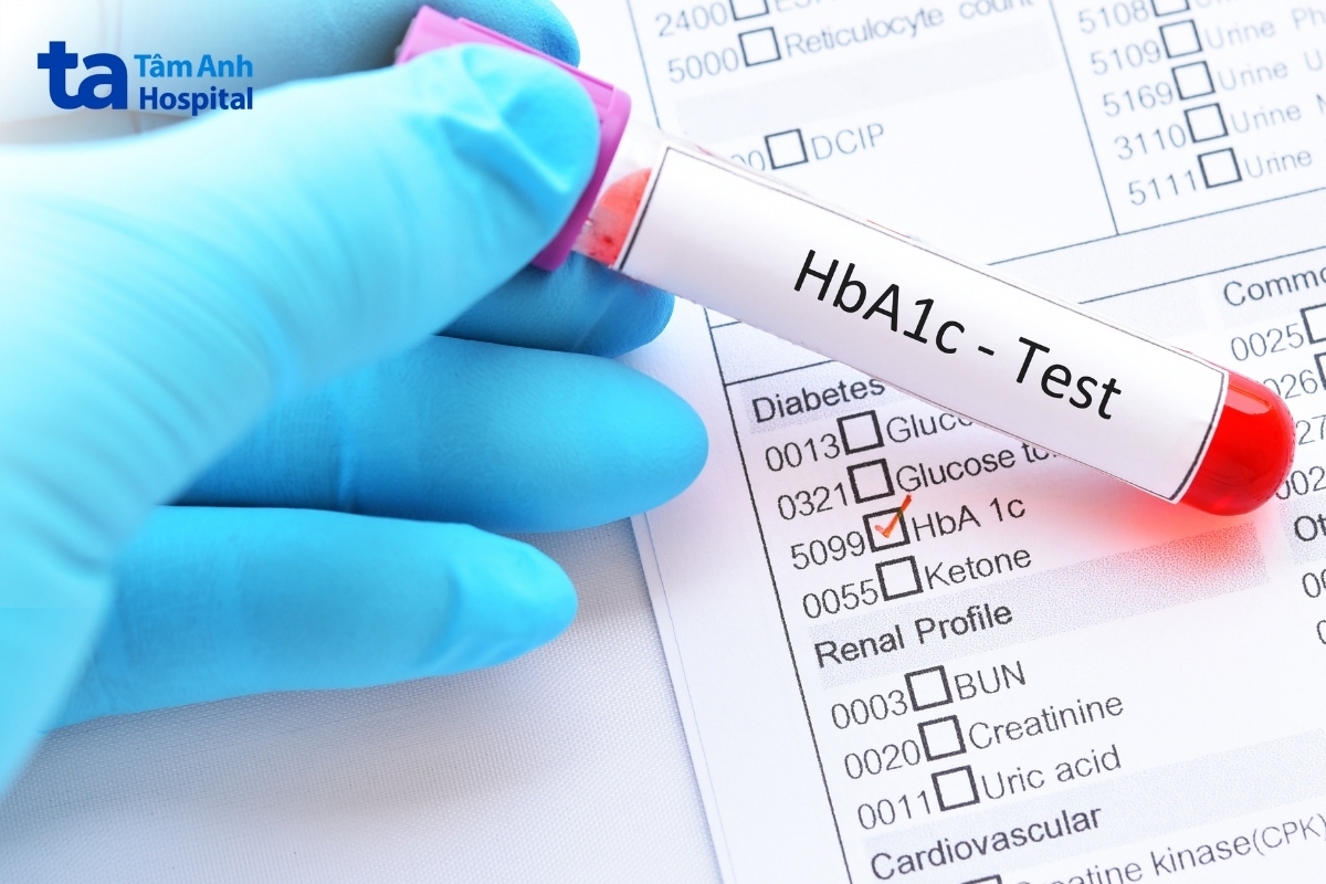 giảm chỉ số hba1c giúp kiểm soát đường huyết hiệu quả