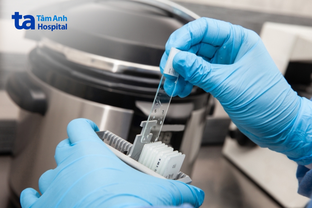 Các Thông Tin Về U Thần Kinh Nội Tiết Ở Phổi Hóa Mô Miễn Dịch Giúp Xác Định Nguồn Gốc Tế Bào, Chẩn Đoán, Tiên Lượng Của Các Bệnh Ung Thư