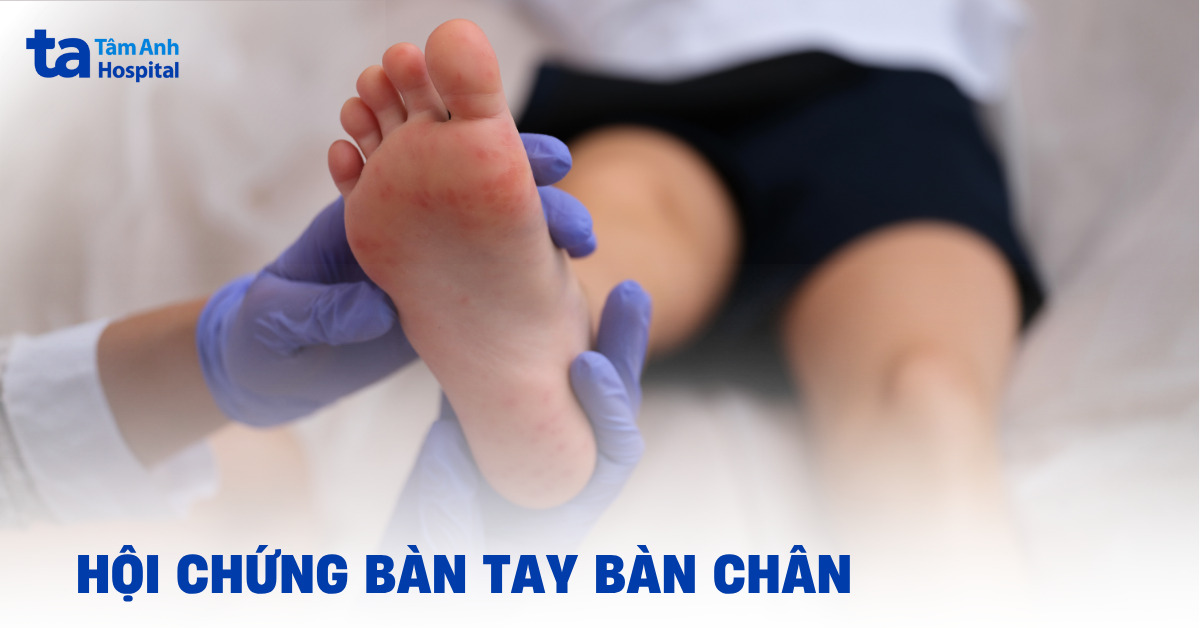 Hội chứng bàn tay bàn chân do hóa trị là gì?