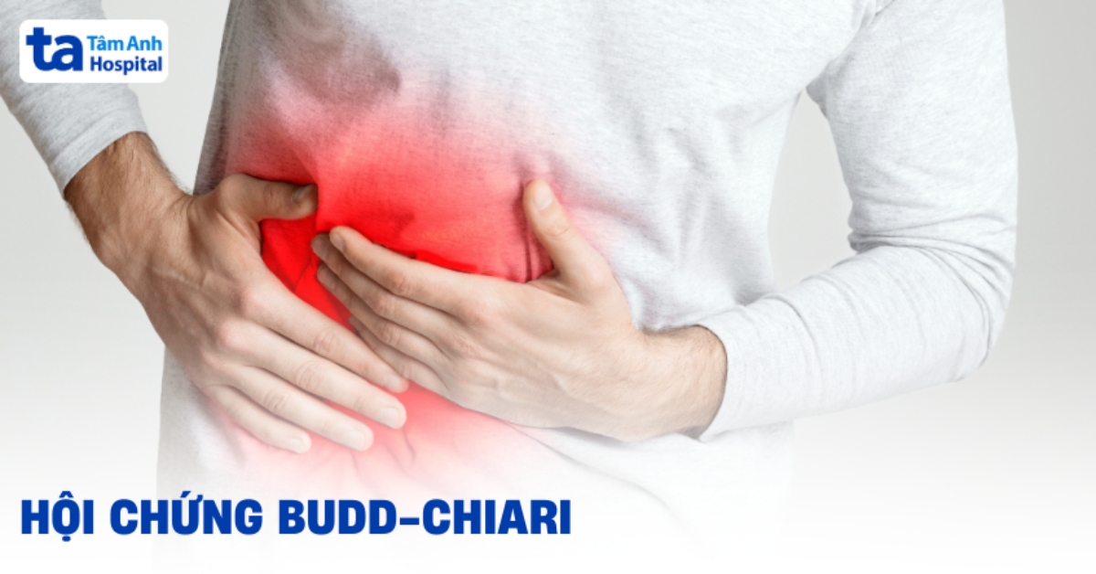 Hội chứng Budd-Chiari là gì? Cơ chế sinh bệnh