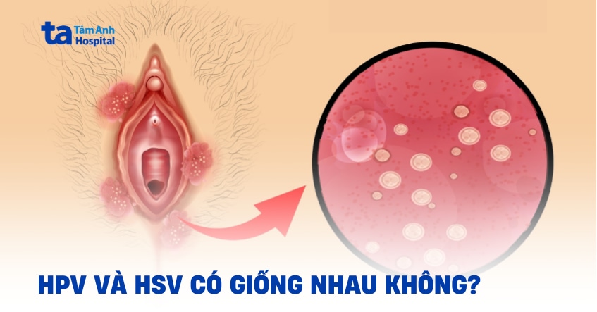 Virus HPV và HSV (Herpes) có giống nhau không? Khác biệt ở đâu?