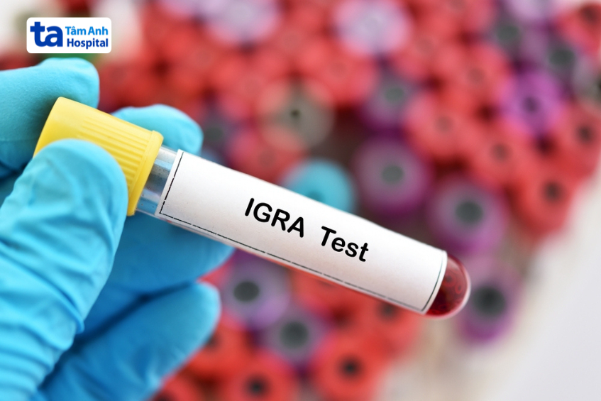 igra là xét nghiệm máu hiện đại, chỉ cần lấy máu một lần và có kết quả trong vòng 24 giờ