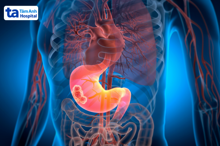Đi Ngoài Phân Đen Là Bệnh Gì? Sẽ Gây Vấn Đề Không? Đi Cầu Ra Màu Đen