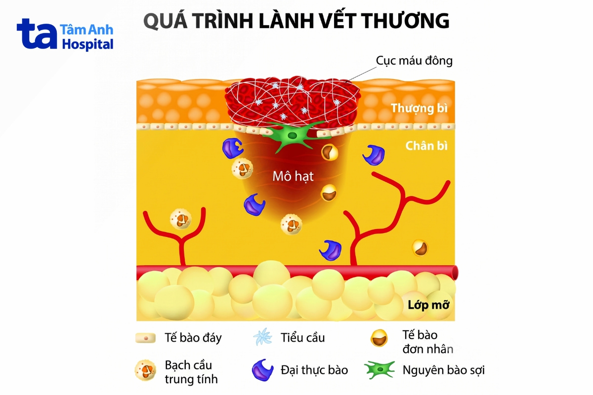 liệu pháp oxy cao áp hbot