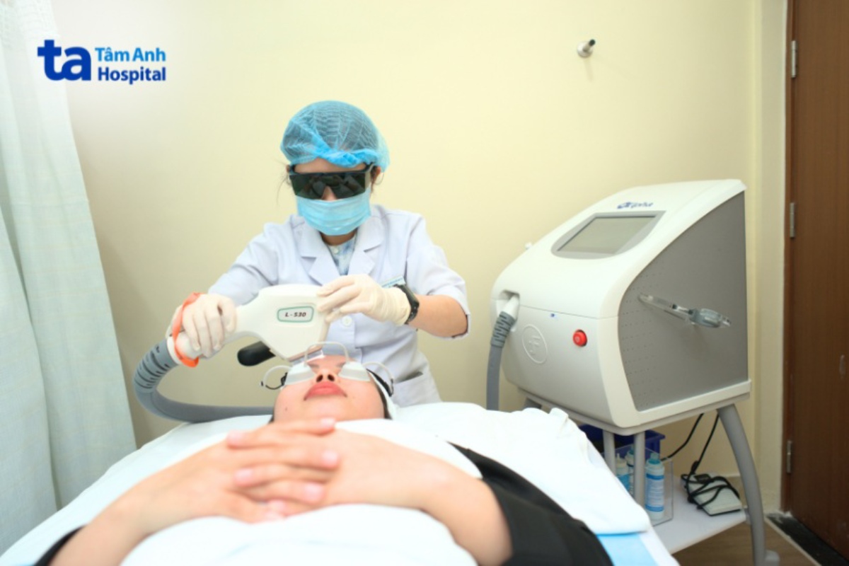 bac sĩ điều trị ipl