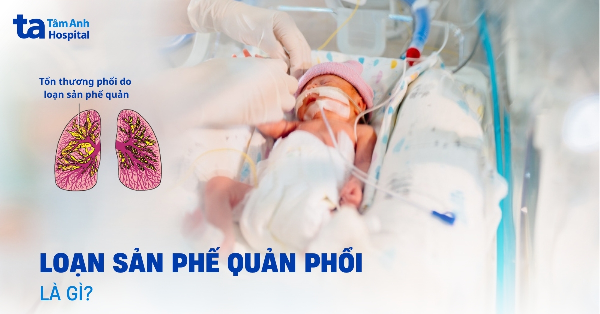 Loạn sản phế quản phổi là gì? Từ nguyên nhân đến chăm sóc dài hạn