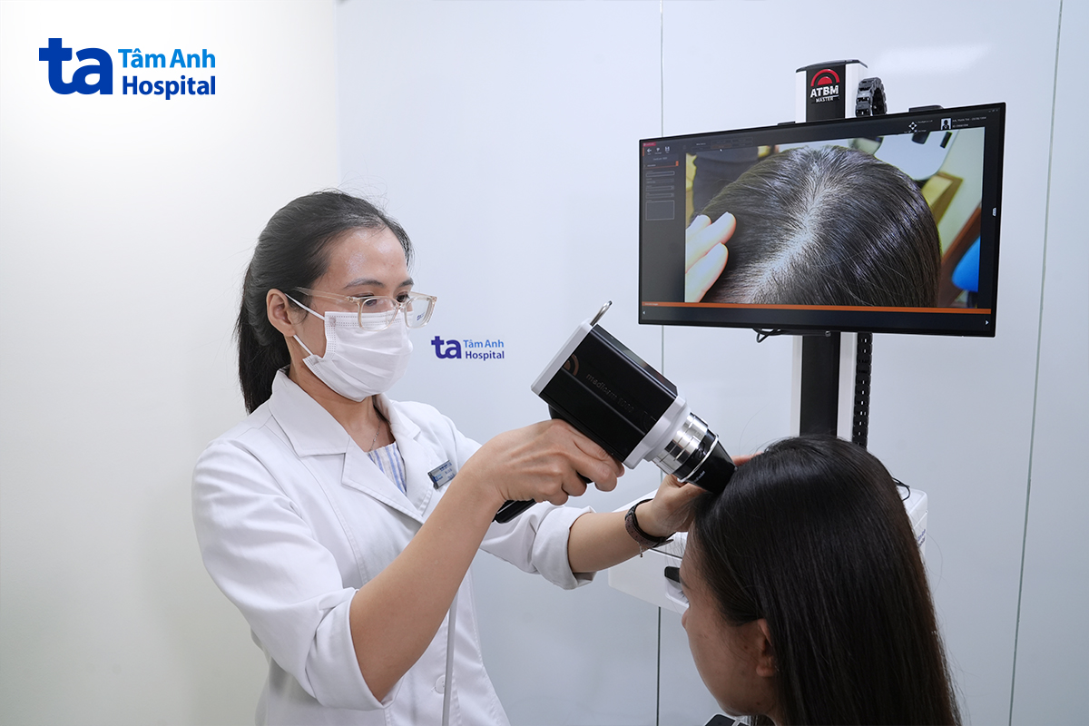máy dermoscopy soi da đầu khách hàng