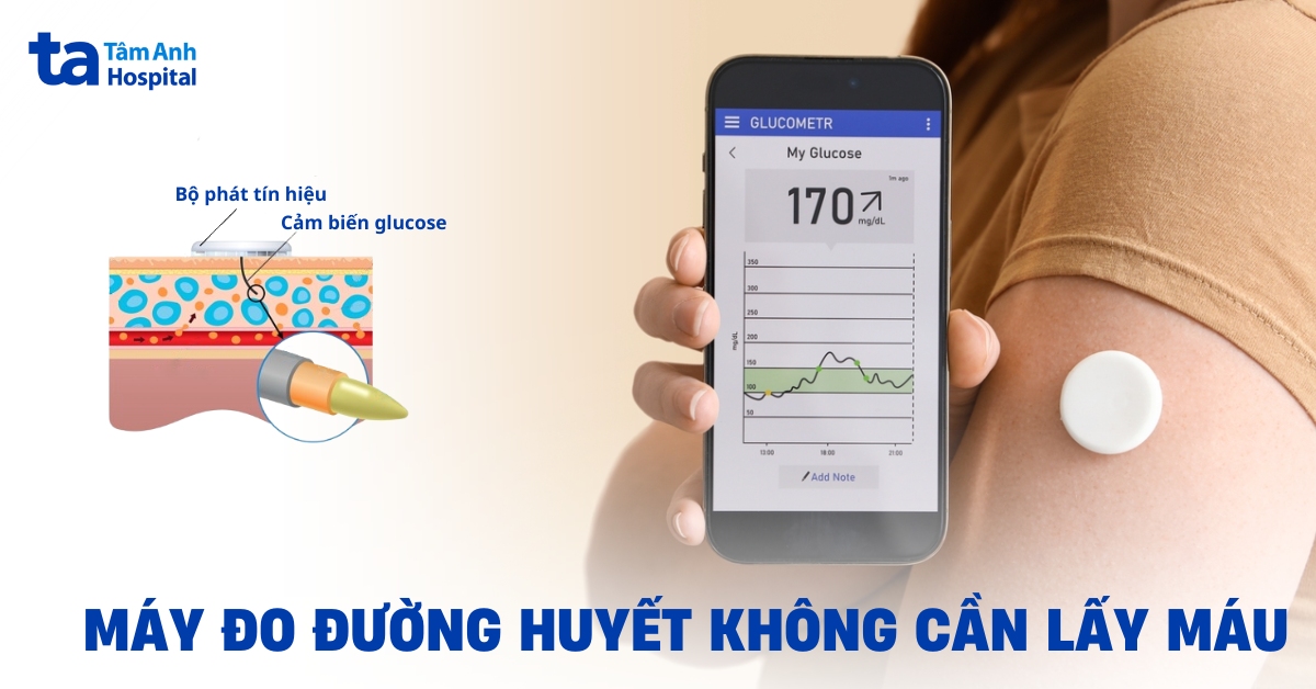 Độ chính xác của máy đo đường huyết không cần lấy máu như thế nào?