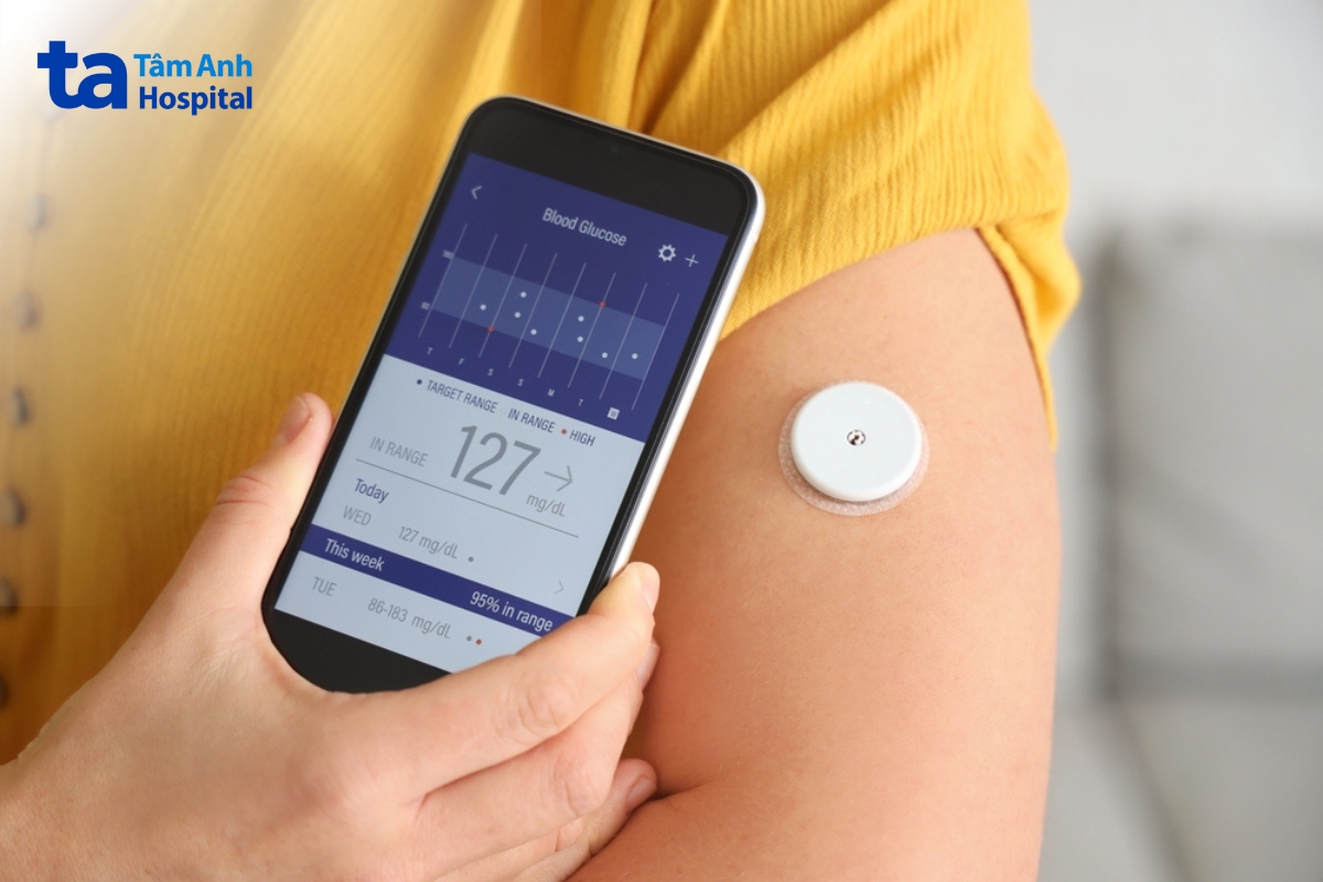 máy đo đường huyết liên tục có thể cung cấp dữ liệu đầy đủ