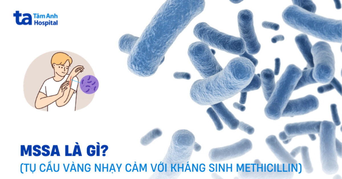 MSSA là gì? Nguyên nhân gây bệnh và các loại thường gặp