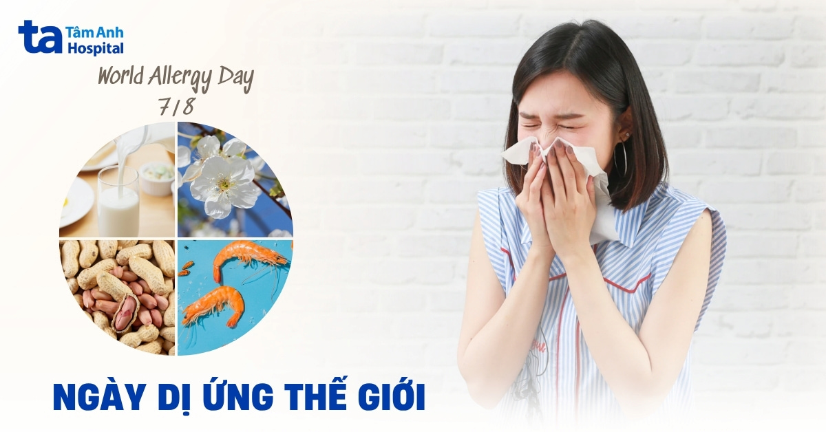 Ngày Dị ứng Thế giới 8/7: Ý nghĩa và cách phòng ngừa