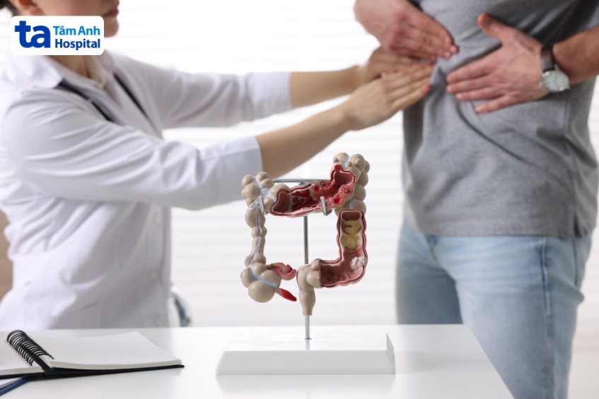 tiêu chảy phân mỡ có nguy hiểm không