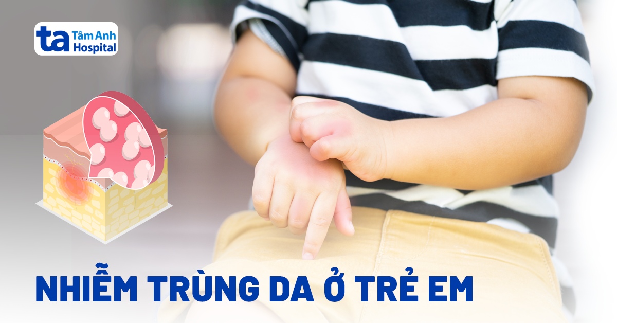 Tại sao nhiễm trùng da ở trẻ em cần sự quan tâm của cha mẹ?