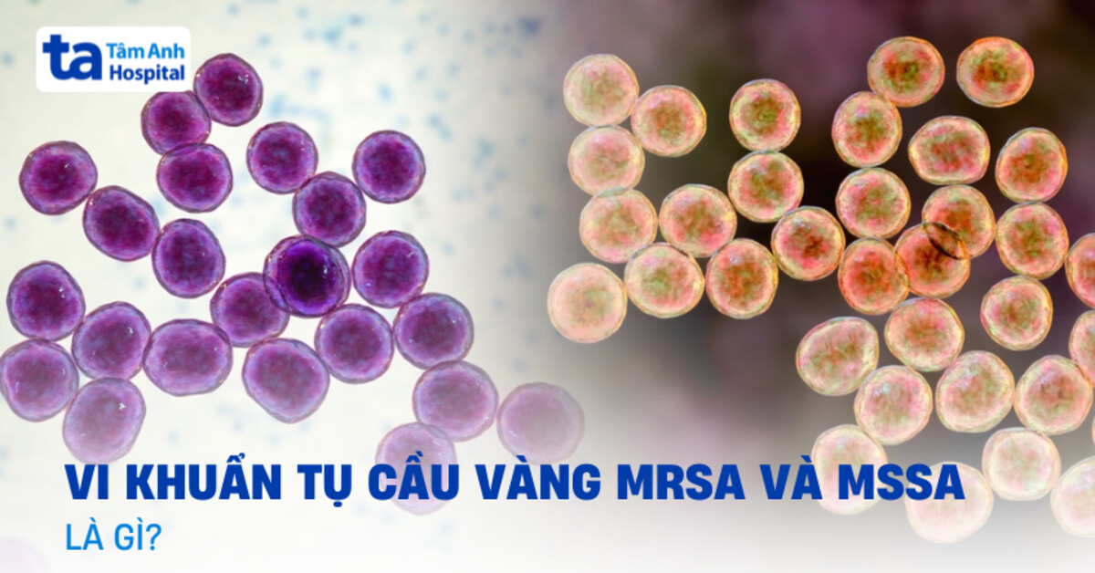 MRSA và MSSA khác nhau như thế nào? Bảng phân biệt