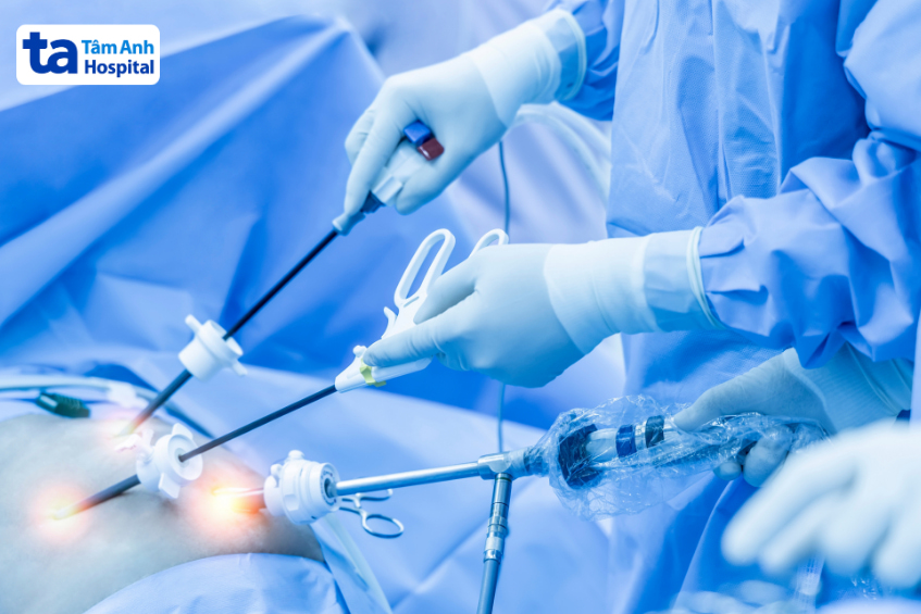 Phẫu thuật nội soi điều trị xoắn túi mật.