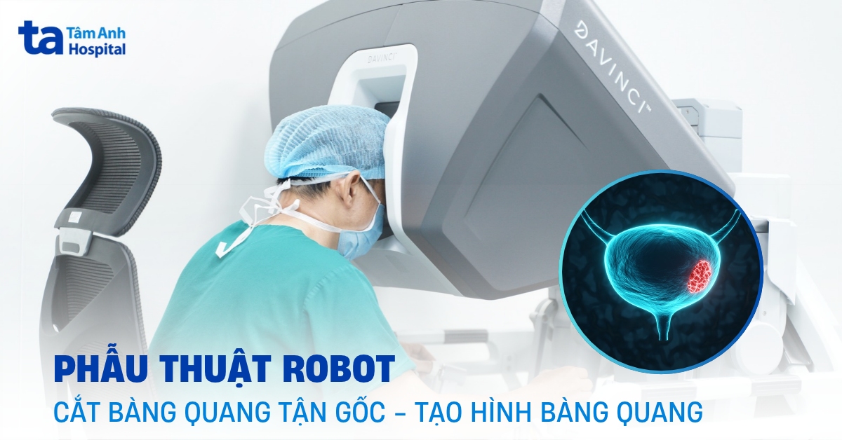 Phẫu thuật robot cắt bàng quang tận gốc: Ưu điểm và quy trình