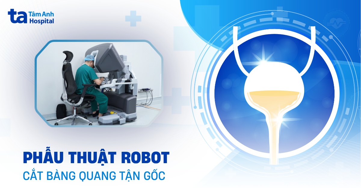 Phẫu thuật robot cắt bàng quang tận gốc: Ưu điểm và quy trình