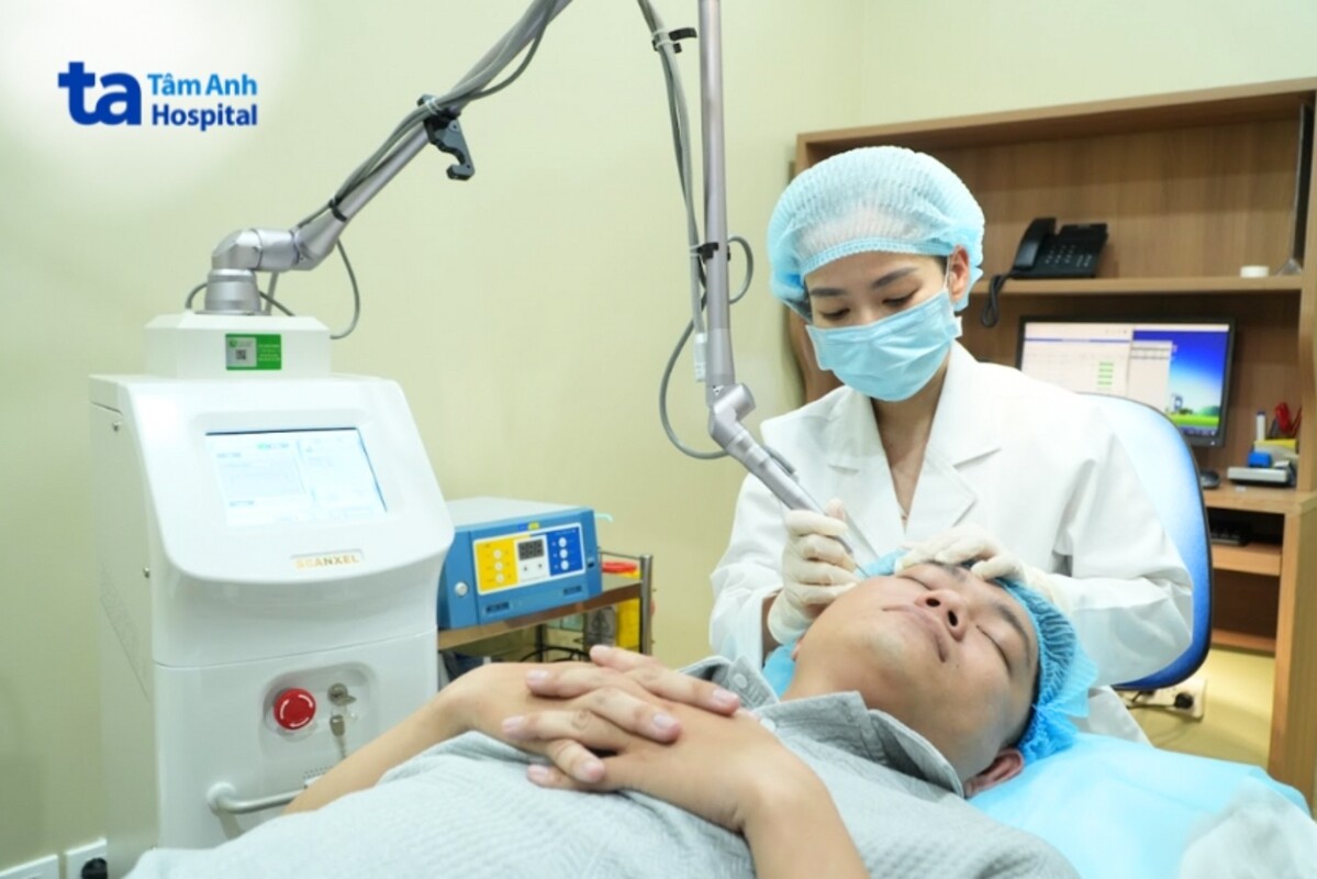 quy trình điều trị u mềm treo bằng laser co2