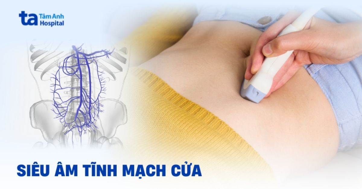 Hiểu đúng về siêu âm tĩnh mạch cửa: Quy trình thực hiện