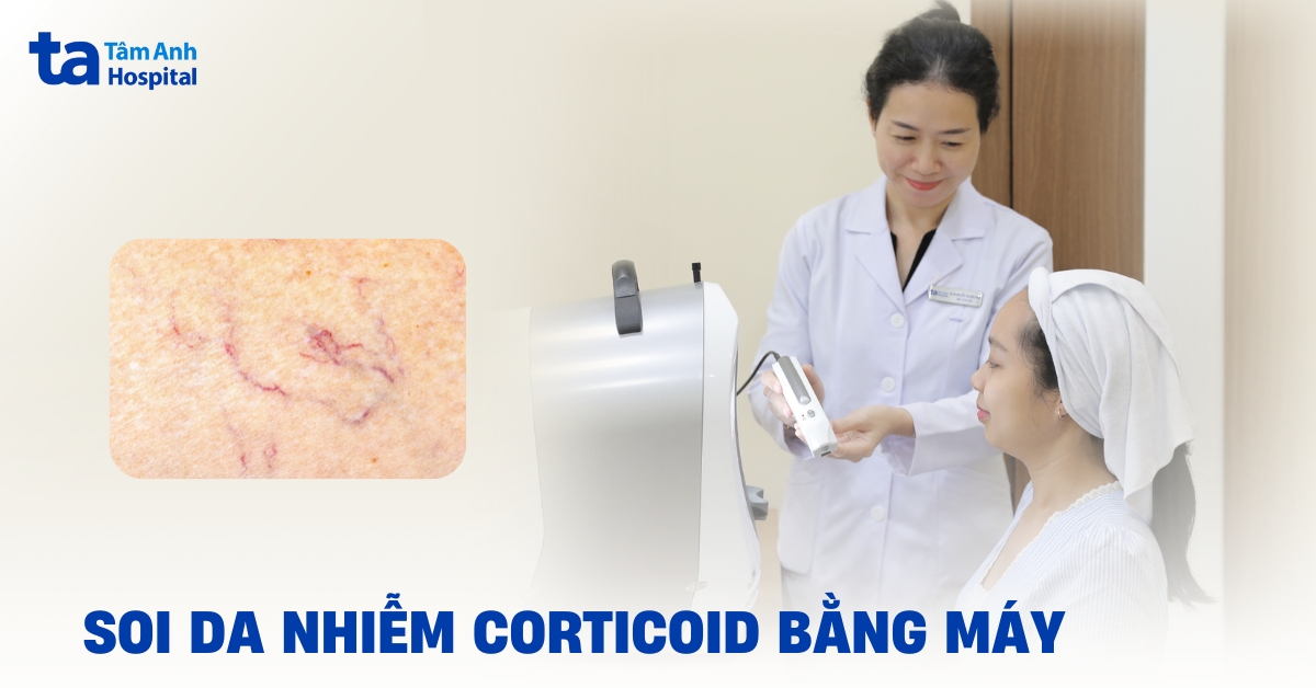 Soi da nhiễm corticoid bằng máy có chính xác không?