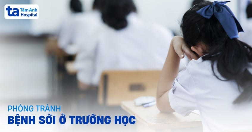 Phòng ngừa bệnh sởi ở trường học và quy trình xử lý khi nghi ngờ