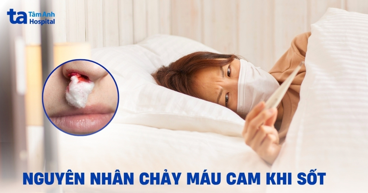 Căn nguyên gây sốt chảy máu mũi và cách xử lý