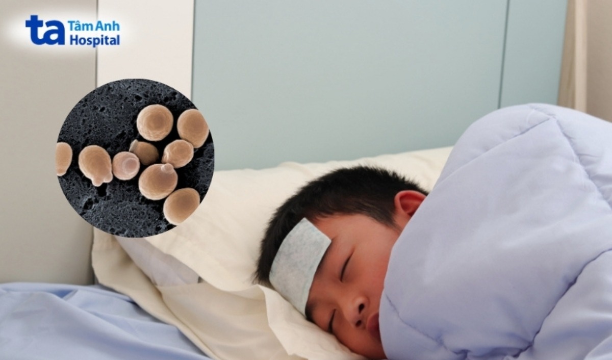 Nhiễm Nấm Bị Sốt