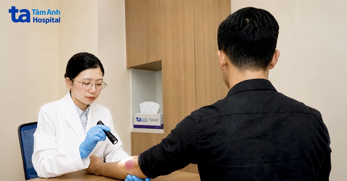 Sốt kéo dài, nổi mẩn đỏ vì hội chứng da ít gặp