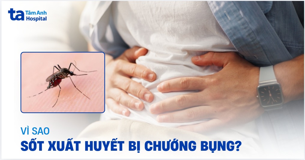 Sốt Xuất Huyết Bị Chướng Bụng