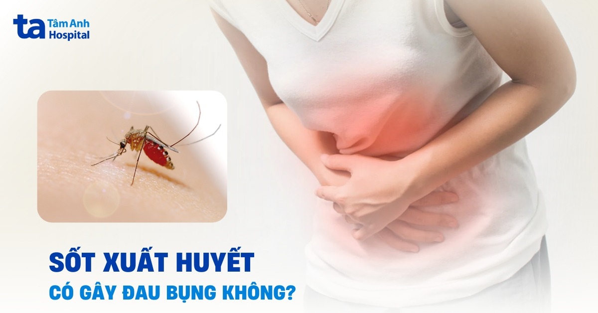 Sốt xuất huyết có đau bụng không? Làm sao giảm đau?