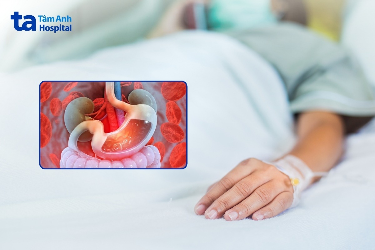 sốt xuất huyết gây suy đa tạng