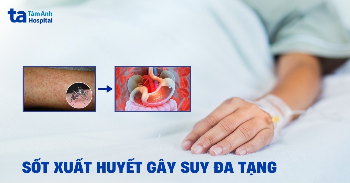Suy đa tạng do sốt xuất huyết: Cơ quan nào bị ảnh hưởng?