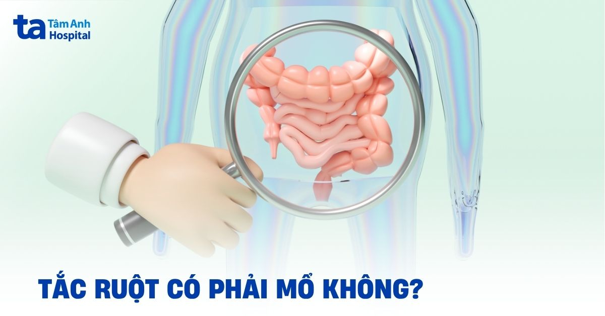 Tắc ruột có phải mổ không? Trường hợp nào không cần thiết?