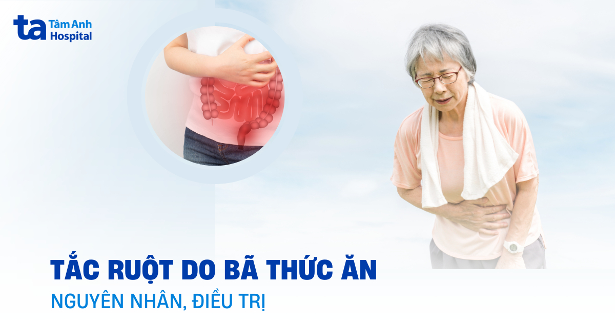 Tắc ruột do bã thức ăn: Đừng chủ quan với thói quen ăn uống